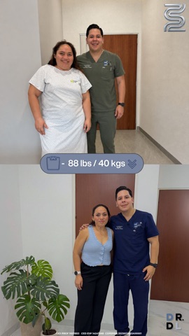 Paciente antes y después, bajó 40 kg