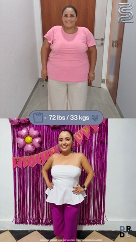 Paciente antes y después, bajó 33 kg