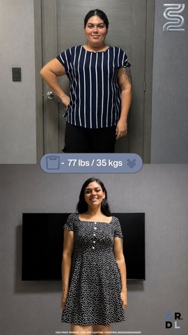 Paciente antes y después, bajó 35 kg
