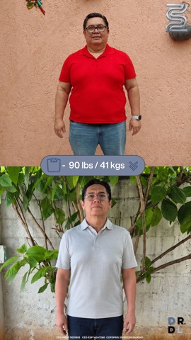 Paciente antes y después, bajó 41 kg