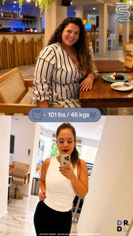 Paciente antes y después, bajó 46 kg
