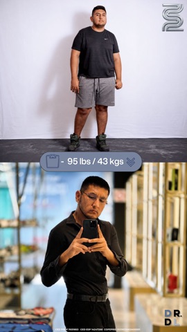 Paciente antes y después, bajó 43 kg