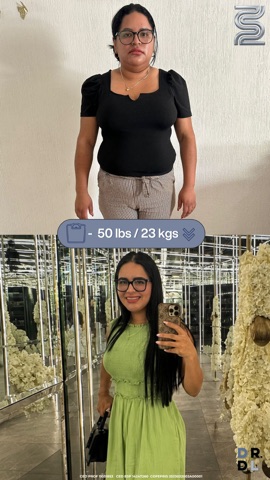 Paciente antes y después, bajó 23 kg
