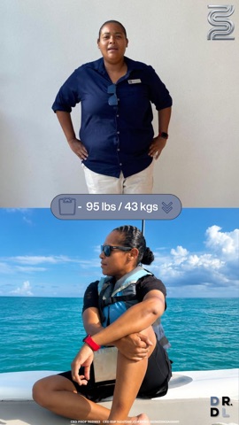 Paciente antes y después, bajó 43 kg