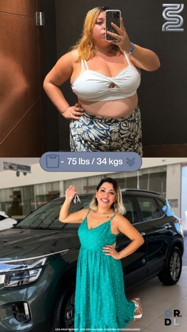 Paciente antes y después, bajó 34 kg