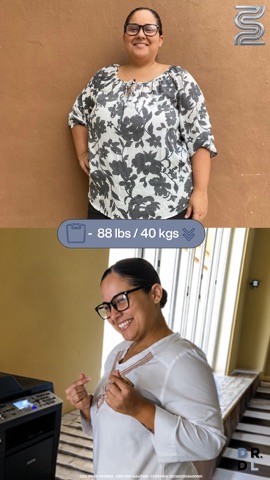 Paciente antes y después, bajó 40 kg