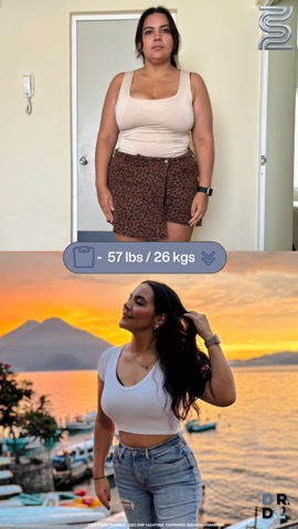 Paciente antes y después, bajó 26 kg