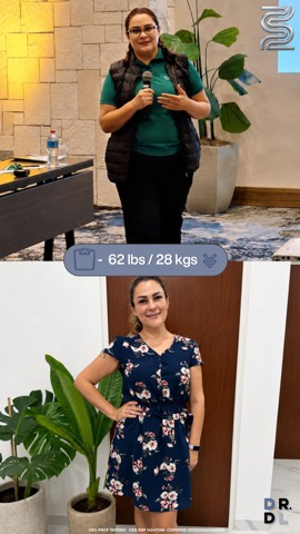 Paciente antes y después, bajó 28 kg