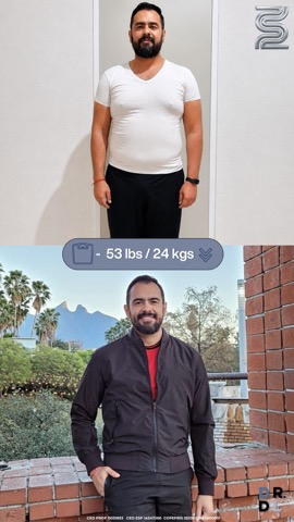 Paciente antes y después, bajó 24 kg