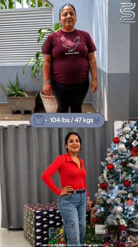 Paciente antes y después, bajó 47 kg
