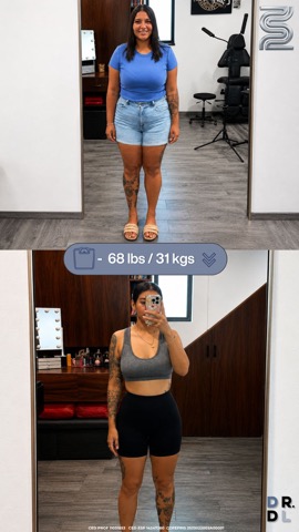 Paciente antes y después, bajó 31 kg