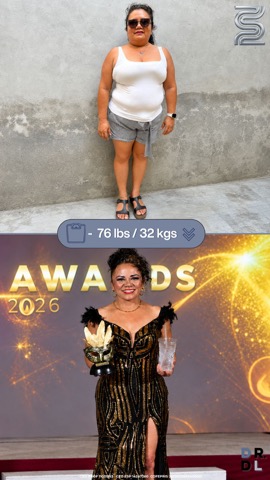 Paciente antes y después, bajó 32 kg