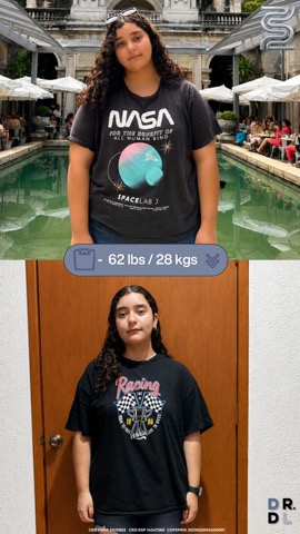 Paciente antes y después, bajó 28 kg