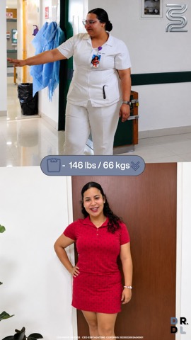 Paciente antes y después, bajó 66 kg