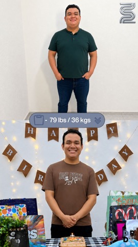 Paciente antes y después, bajó 36 kg