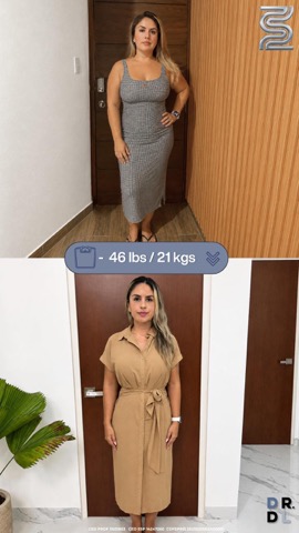 Paciente antes y después, bajó 21 kg