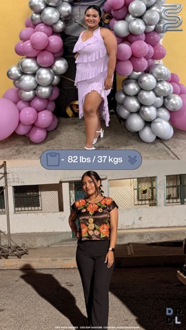Paciente antes y después, bajó 37 kg