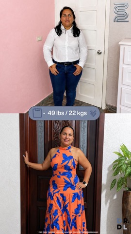 Paciente antes y después, bajó 22 kg