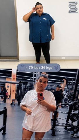 Paciente antes y después, bajó 36 kg