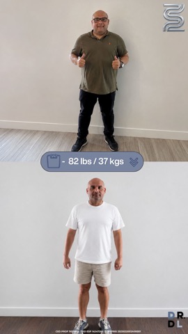 Paciente antes y después, bajó 37 kg