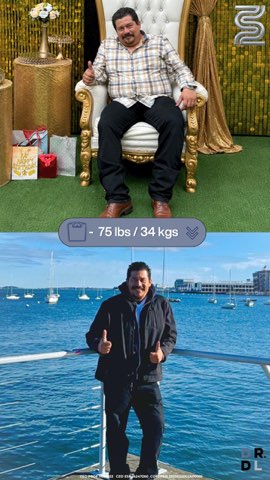 Paciente antes y después, bajó 34 kg