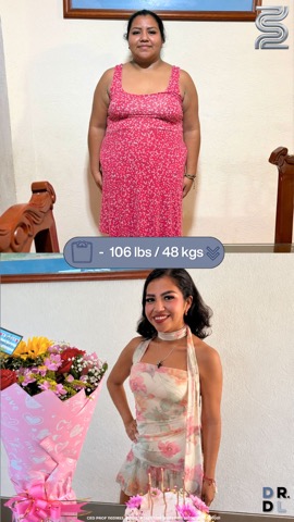 Paciente antes y después, bajó 48 kg
