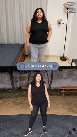 Paciente antes y después, bajó 47 kg
