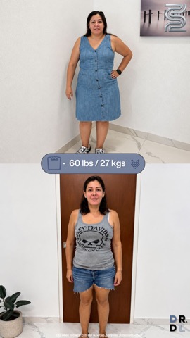 Paciente antes y después, bajó 27 kg