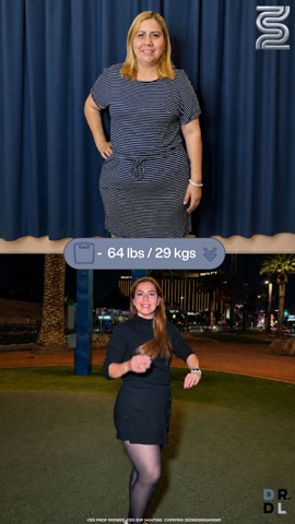 Paciente antes y después, bajó 29 kg