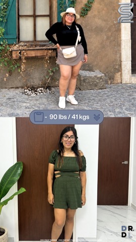Paciente antes y después, bajó 41 kg