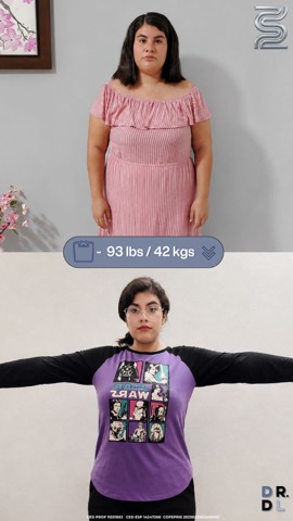Paciente antes y después, bajó 42 kg