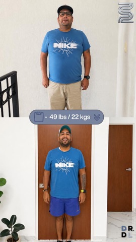 Paciente antes y después, bajó 22 kg