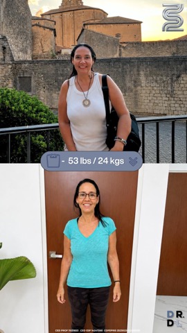 Paciente antes y después, bajó 24 kg