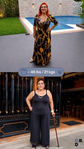 Paciente antes y después, bajó 21 kg
