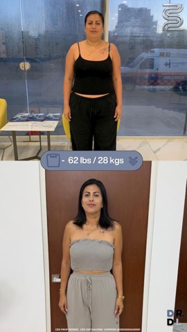 Paciente antes y después, bajó 28 kg