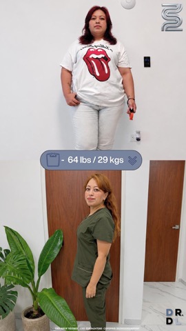 Paciente antes y después, bajó 29 kg