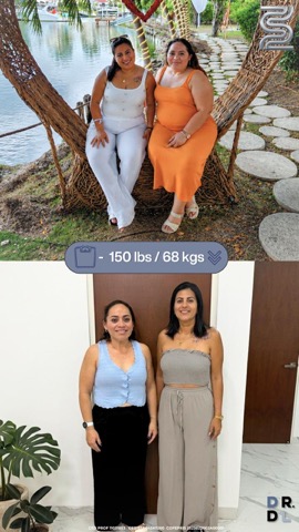 Paciente antes y después, bajó 68 kg