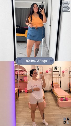 Paciente antes y después, bajó 37 kg