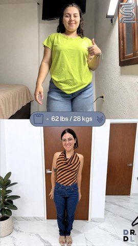 Paciente antes y después, bajó 28 kg