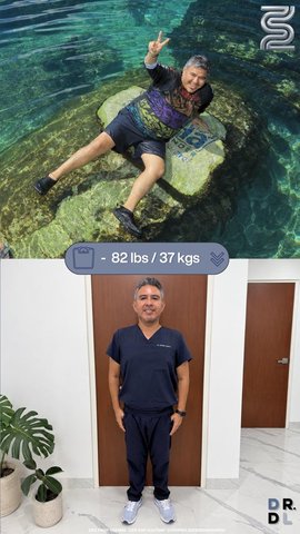 Paciente antes y después, bajó 37 kg