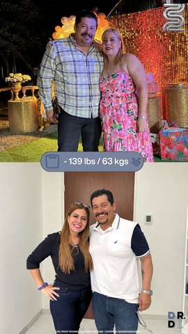 Paciente antes y después, bajó 63 kg