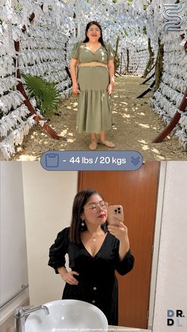 Paciente antes y después, bajó 20 kg