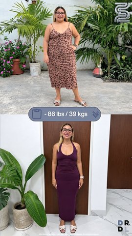 Paciente antes y después, bajó 39 kg