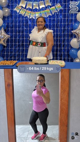 Paciente antes y después, bajó 29 kg