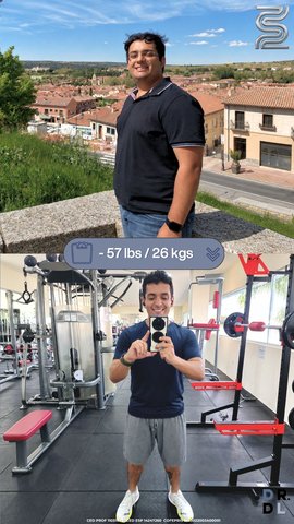 Paciente antes y después, bajó 26 kg