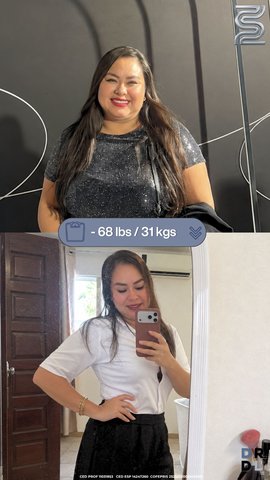 Paciente antes y después, bajó 31 kg