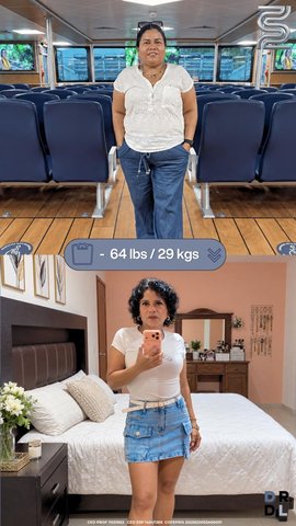 Paciente antes y después, bajó 29 kg