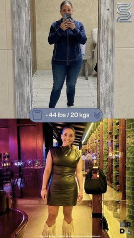 Paciente antes y después, bajó 20 kg