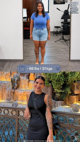 Paciente antes y después, bajó 31 kg