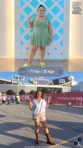 Paciente antes y después, bajó 35 kg